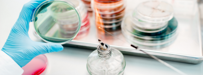 Person holding a petri dish and swab above a spirit burner and other petri dishes on lab bench surface.